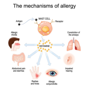 Understanding Allergies: Causes, Symptoms, and Treatment Options